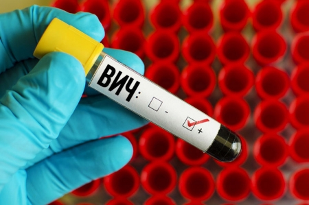 За 10 месяцев выявлены 85 носителей ВИЧ-инфекции За 10 месяцев выявлены 85 носителей ВИЧ-инфекции