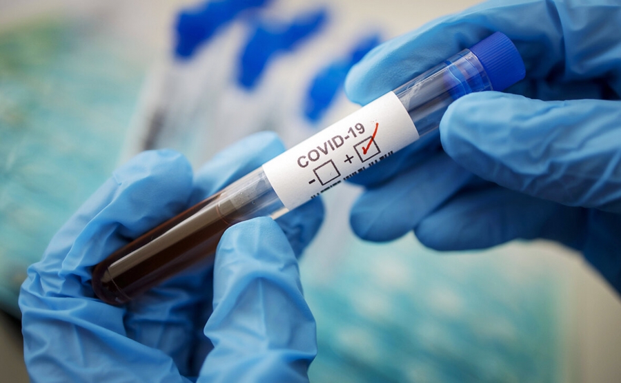В Северске 63 подтвержденных случая COVID-19 В Северске 63 подтвержденных случая COVID-19