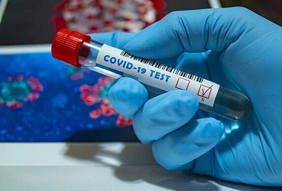 В Северске зарегистрировано 382 подтверждённых случая COVID-19 В Северске зарегистрировано 382 подтверждённых случая COVID-19