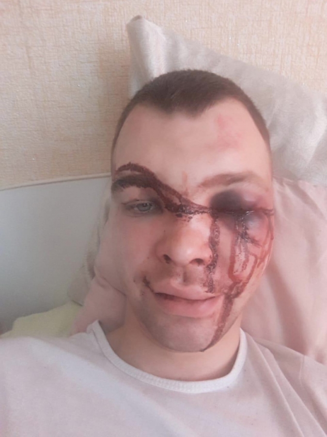 Мама избитого в Северске: Он прислал фотографию, там было месиво, а не лицо Мама избитого в Северске: Он прислал фотографию, там было месиво, а не лицо