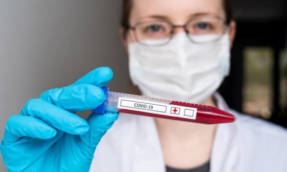 Количество подтвержденных случаев COVID-19 увеличилось до 2715 Количество подтвержденных случаев COVID-19 увеличилось до 2715