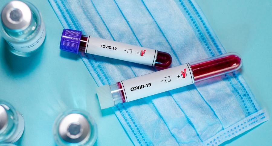 В Северске зарегистрировано уже почти 3,5 тысячи случаев COVID-19 В Северске зарегистрировано уже почти 3,5 тысячи случаев COVID-19