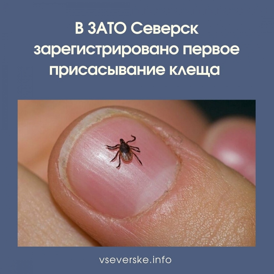 В ЗАТО Северск зарегистрировано первое присасывание клеща В ЗАТО Северск зарегистрировано первое присасывание клеща