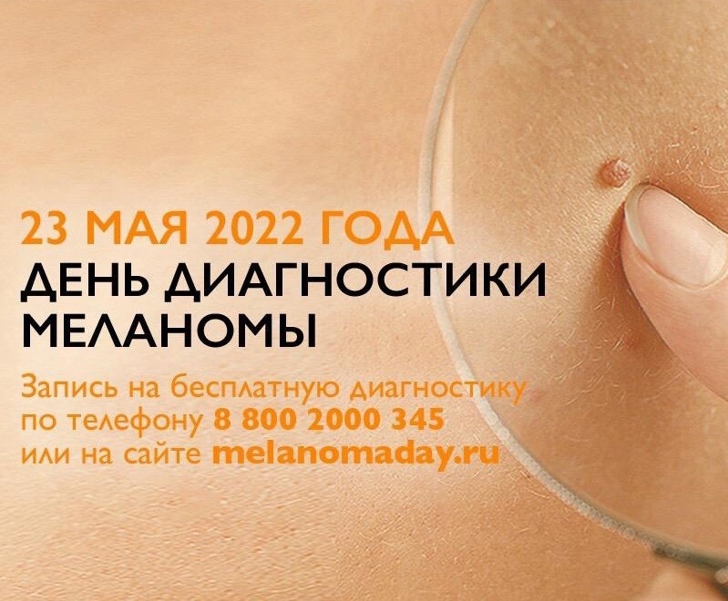 23 мая – День диагностики меланомы 23 мая – День диагностики меланомы